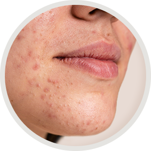 Imagem Dermatologia Clínica
